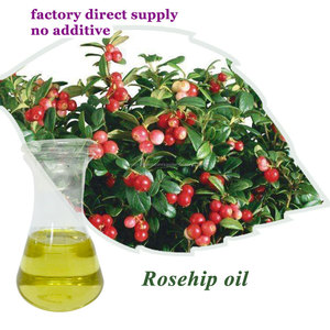 Popular producto cuidado de <span class=keywords><strong>la</strong></span> piel prensado en frío aceite de <span class=keywords><strong>rosa</strong></span> mosqueta - Product Image 1