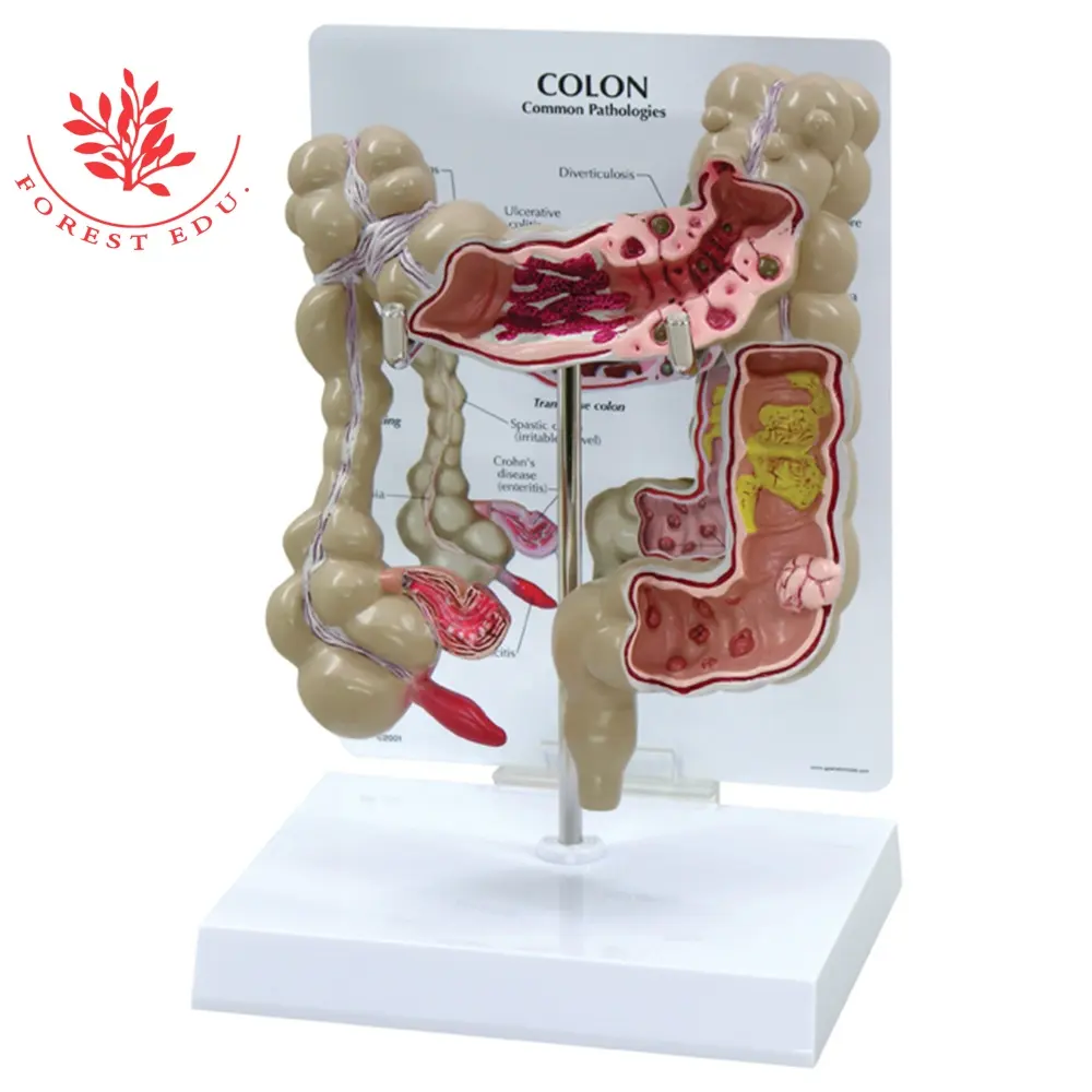 Modelo de ciencia médica para la enseñanza del dolor de columna humano, modelo de Anatomia para la enfermedad común en el recto