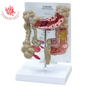 Teaching Resource Human Colon, Rectum Common Disease Anatomy Model Medical Science