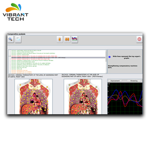 Metaton Huter <span class=keywords><strong>Bioresonance</strong></span> DNA testi ile 4025 <span class=keywords><strong>NLS</strong></span> Vücut tarayıcı - Product Image 2