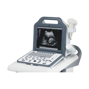 Máquina de ultrasonido Digital para <span class=keywords><strong>embarazo</strong></span>, MSLPU50, portátil, precio barato - Product Image 2