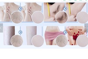 2023 caliente profesional perla luz cera microcristalina 100g depilación cera dura frijoles rosa para mujeres cara, piernas y cuerpo - Product Image 6