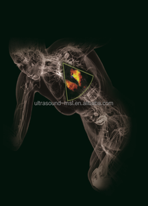 Sonoscape S9 High-End Tangan <span class=keywords><strong>Doppler</strong></span> Berwarna Terjemahan Mindray M7 Mesin Ultrasound - Product Image 6