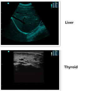 BR-US21 80 요소 휴대용 12 인치 LED 디스플레이 2 프로브 인터페이스 컬러 도플러 초음파 스캐너 기계 - Product Image 5