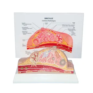 人工病理女性乳房解剖模型