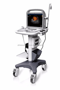 Appareil d'échographie Doppler couleur portable 3D 4D <span class=keywords><strong>Sonoscape</strong></span> <span class=keywords><strong>S6</strong></span> / Appareil d'échographie <span class=keywords><strong>Sonoscape</strong></span> de haute qualité - Product Image 3