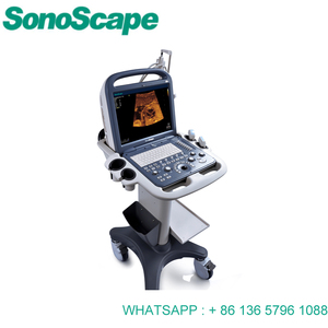 Sonoscape s2 ultrasound machine prijs/kleur doppler - Product Image 2