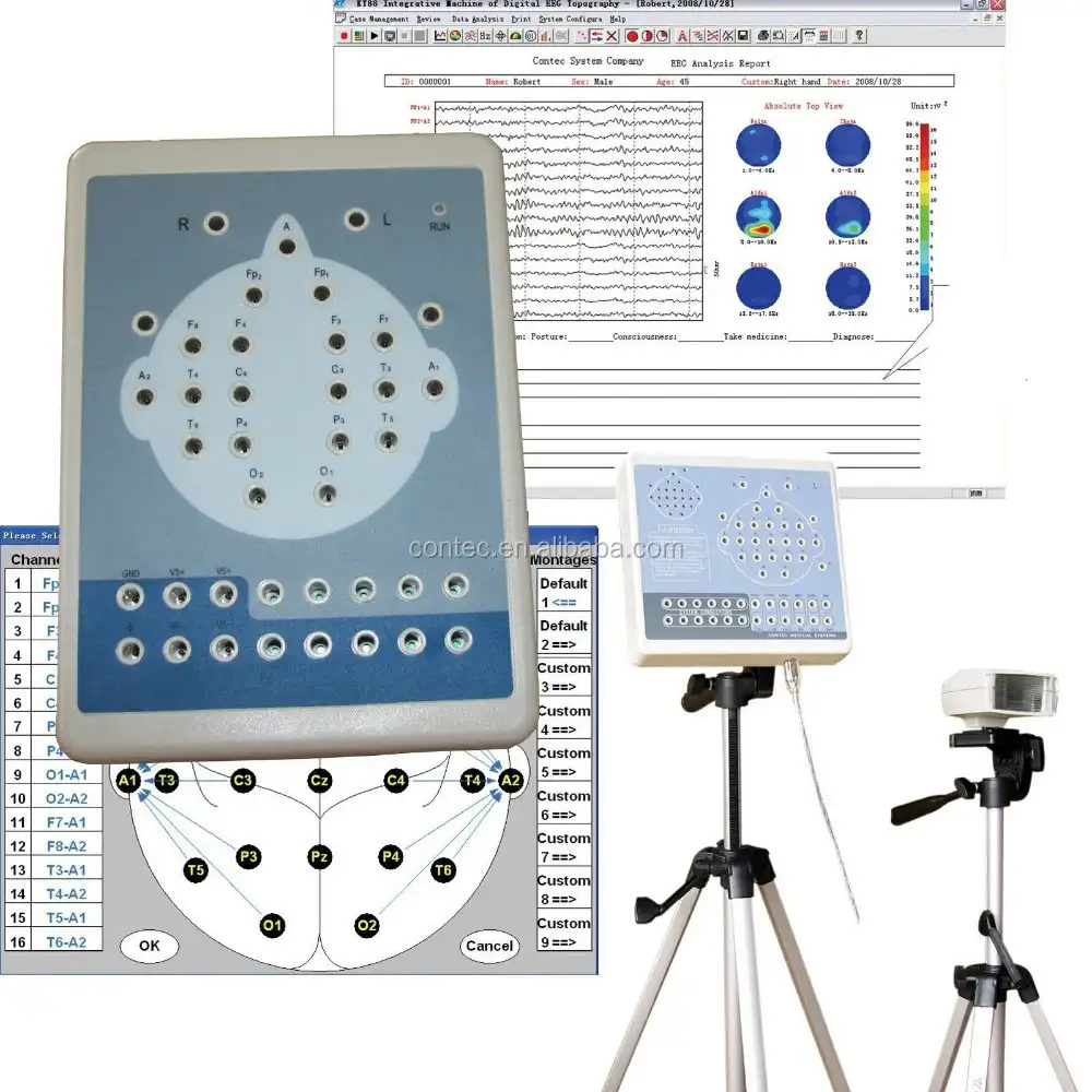 Sistema de EEG Eletroencefalograma CONTEC KT88-1018 Digital equipamentos Médicos