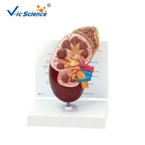 Medische Wetenschap Anatomisch Model Menselijke Nierdissectie Modelorganen Onderwijsmodel