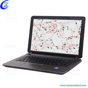 동물용 휴대용 정액 분석기 - Product Image 5