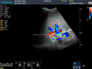 <span class=keywords><strong>3D</strong></span> <span class=keywords><strong>4D</strong></span> Sonoscape Serbaguna S12 Warna Doppler <span class=keywords><strong>Ultrasound</strong></span> untuk OB/GYN Cardiic MSK - Product Image 6
