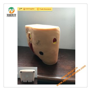 PVC diseño Ancianos úlceras por presión modelo de formación de enfermería - Product Image 1