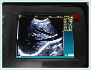 MSLVU04S embarazo veterinaria ultrasonido escáner/<span class=keywords><strong>ecografia</strong></span> del embarazo para animales/transductor - Product Image 3