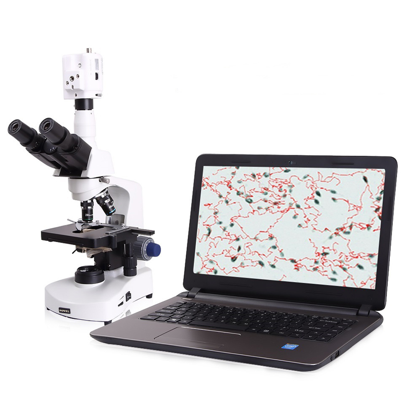 Veterinary Laboratory Equipment Semen Analyzer Sperm