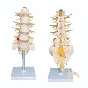 אדם Lumbosacral חוליות ועצבים שלד האנטומיה מבנה דגם