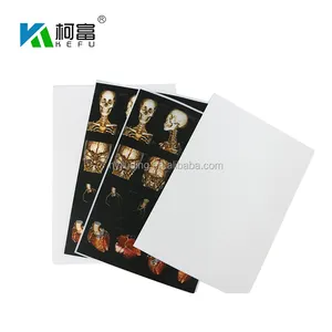 <span class=keywords><strong>Film</strong></span> radiographique médical opaque blanc pour impression d'images sur imprimante jet d'encre Epson et Canon - Product Image 1