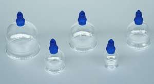 Europaweit Beliebtes Bestseller Vakuum-Hijama-Schröpfgläser-Set, 14-teiliger Koffer - Product Image 3