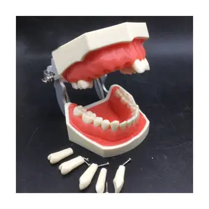 Diş implantı modeli, diş modeli ile patolojiler, çıkarılabilir diş modeli