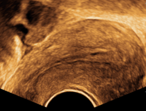 Preço da máquina de ultra-sonografia <span class=keywords><strong>Mindray</strong></span> <span class=keywords><strong>dc</strong></span> 30/trolly carrinho - Product Image 6