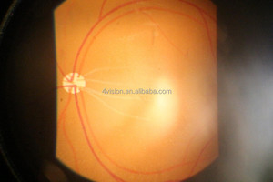<span class=keywords><strong>Fundus</strong></span> görüntüleme görüntüleyici sistemi masaüstü yarık lamba - Product Image 5