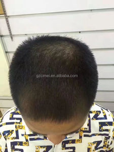 OEM China Professionelle Lieferanten Design Entspannt Linie Groß Haar Wachstum Produkt Natürliche Haarpflege Produkt Private Label haarpflege - Product Image 6