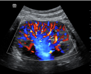 Preço da máquina de ultra-sonografia <span class=keywords><strong>Mindray</strong></span> <span class=keywords><strong>dc</strong></span> 30/trolly carrinho - Product Image 4
