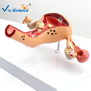 Medizinisches anatomisches Modell weibliche reproduktive patho logische Modelle medizinisches Bildungs modell - Product Image 5