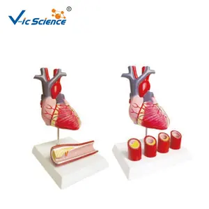 Медицинская анатомическая обучающая модель из ПВХ, модель человеческого сердца, прикрепить больную артерию, образовательная модель vas