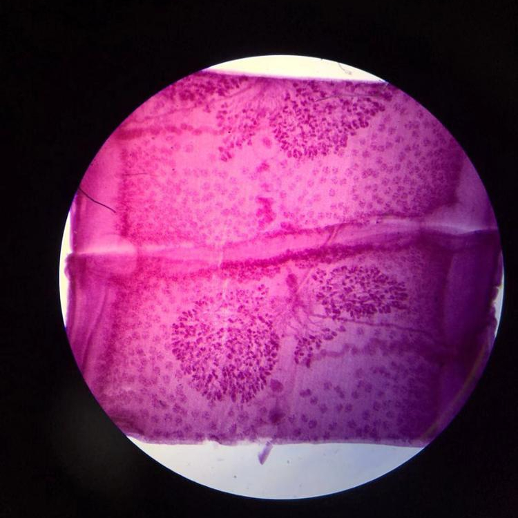 Индивидуальный микроскоп, подготовленные слайды, медицинский паразитарный микроскоп, слайды, патобиология, приготовленные слайды