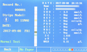 Análisis de orina instrumento humano veterinario/W-600 merydi completo automático Analizador de orina - Product Image 6