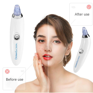 <span class=keywords><strong>Dropshipping</strong></span> Comedone Aspirapolvere di Aspirazione Della Cheratina di Rimozione Della Cicatrice Acne Poro Peeling Viso Pulizia Del Viso Cura Della Pelle Macchina di Bellezza - Product Image 4