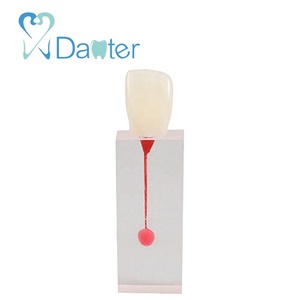 Hars Dentale Endodontische Tandmodel Met Wortelkanaalblok Voor Studentenstudie - Product Image 3