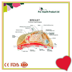 Modelo Anatômico de Doença de Lesão em Patologia Mamária - Product Image 6