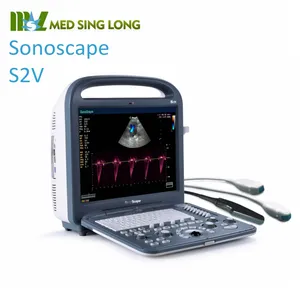 Sonoscape S2V便携式彩色多普勒兽医超声系统牛犬马兽医诊所