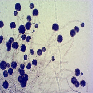 微生物学教育資源菌類とバクテリアが準備したスライド - Product Image 6