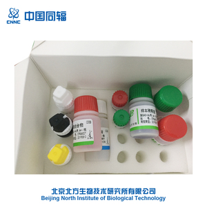 Humanos Diabetes ácido glutámico decarboxylase autoanticuerpo GAD-Ab prueba ELISA Kit - Product Image 2