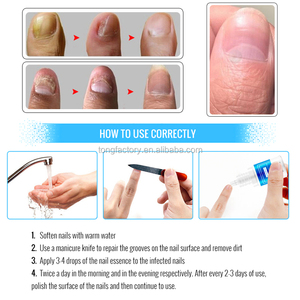 OMYLADY Traitement De Champignon D'<span class=keywords><strong>ongle</strong></span> D'herbe <span class=keywords><strong>Ongle</strong></span> Réparation Crème - Product Image 6