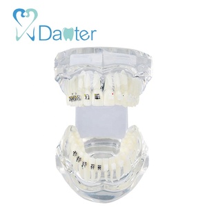 Modello Anatomico Dentale Ortodontico in Resina Plastica per Comunicazione Professionale con Pazienti - Product Image 3