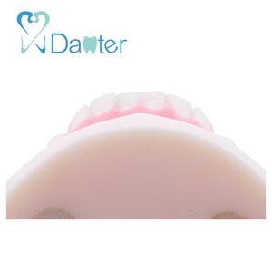 La maggior parte dei Popolari Pratica Pratica di Impianto Mandibolare Mascella Modello per il Dentista - Product Image 2