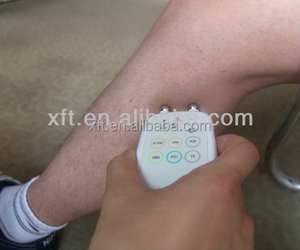 Estimulador de los nervios periféricos - Product Image 3