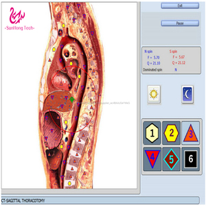 Latest 9d NLS analyzer health equipment physiotherapy disease analysis - Product Image 2
