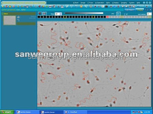 Sanwe SW-<span class=keywords><strong>3702</strong></span> Analisador da Qualidade do Esperma com câmara de contagem de esperma - Product Image 3