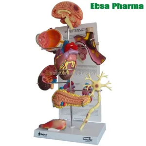 先进的医疗用品人体教学糖尿病器官解剖模型为学校