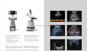 Échographe Doppler couleur Sonoscape S11 haute résolution - Product Image 6