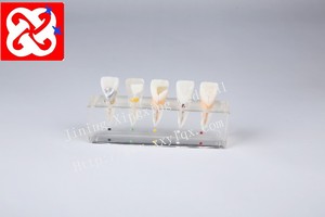 एंडोडोन्टिक उपचार प्रक्रिया प्रदर्शन के लिए एनाटॉमी मॉडल - Product Image 2