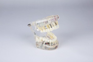 Nieuwe ontwerp Implant & restauratie tandheelkundige model met zenuw voor demonstreren endo training - Product Image 4