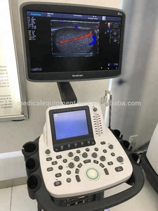 Sonoscope <span class=keywords><strong>S22</strong></span> très puissant à plate-forme, doppler de couleur à ultrasons, meilleur prix ultrasonique - Product Image 6