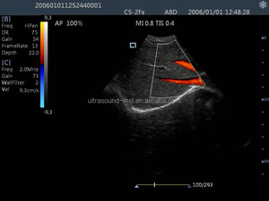 MSLCU25F <span class=keywords><strong>machine</strong></span> à ultrasons doppler Couleur/portable à ultrasons à écran tactile - Product Image 5