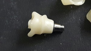 Best selling pilar Implante Dentário sistema ZAHN zircônia para abrir - Product Image 3
