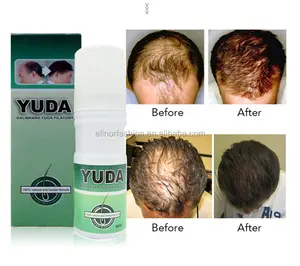 Products in demand 2018 faster hair growth spray , Yuda hair growth liquid